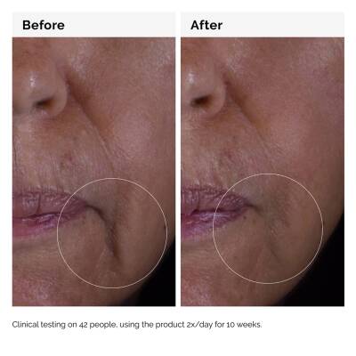 THE ORDINARY Growth Factors Solution 15% - Anti-aging Serum 30ml