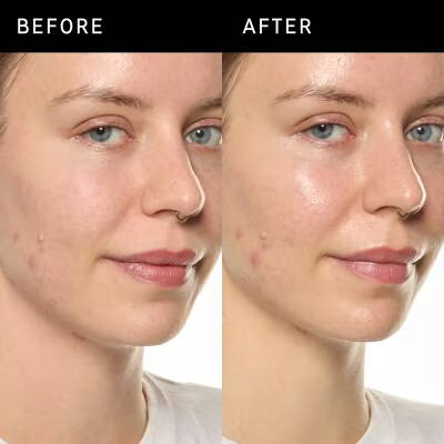 The INKEY List Ectoin Hydro-Barrier Serum 30ml