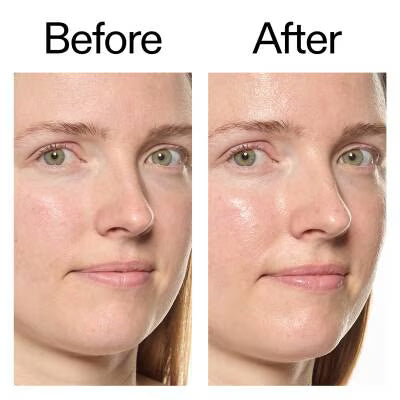 The INKEY List Hydro-Surge Dewy Face Mist 75ml