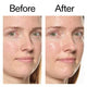 The INKEY List Hydro-Surge Dewy Face Mist 75ml