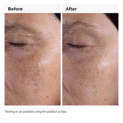 The Ordinary  Glycolic Acid 7% Exfoliating Toner 100ml