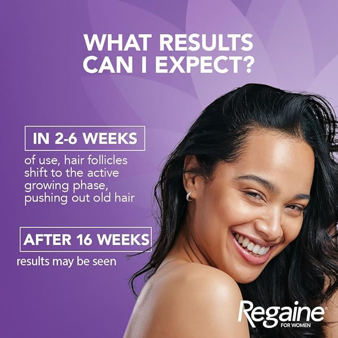 Regaine Women's Regular Strength Hair Loss and Hair Regrowth Solution 60ml