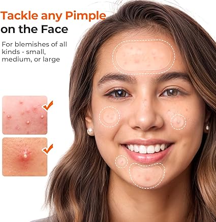 TKTK 443 Count Pimple Patches for Face AMZ
