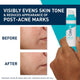 CeraVe Resurfacing Retinol Serum with Ceramides & Niacinamide 30ml