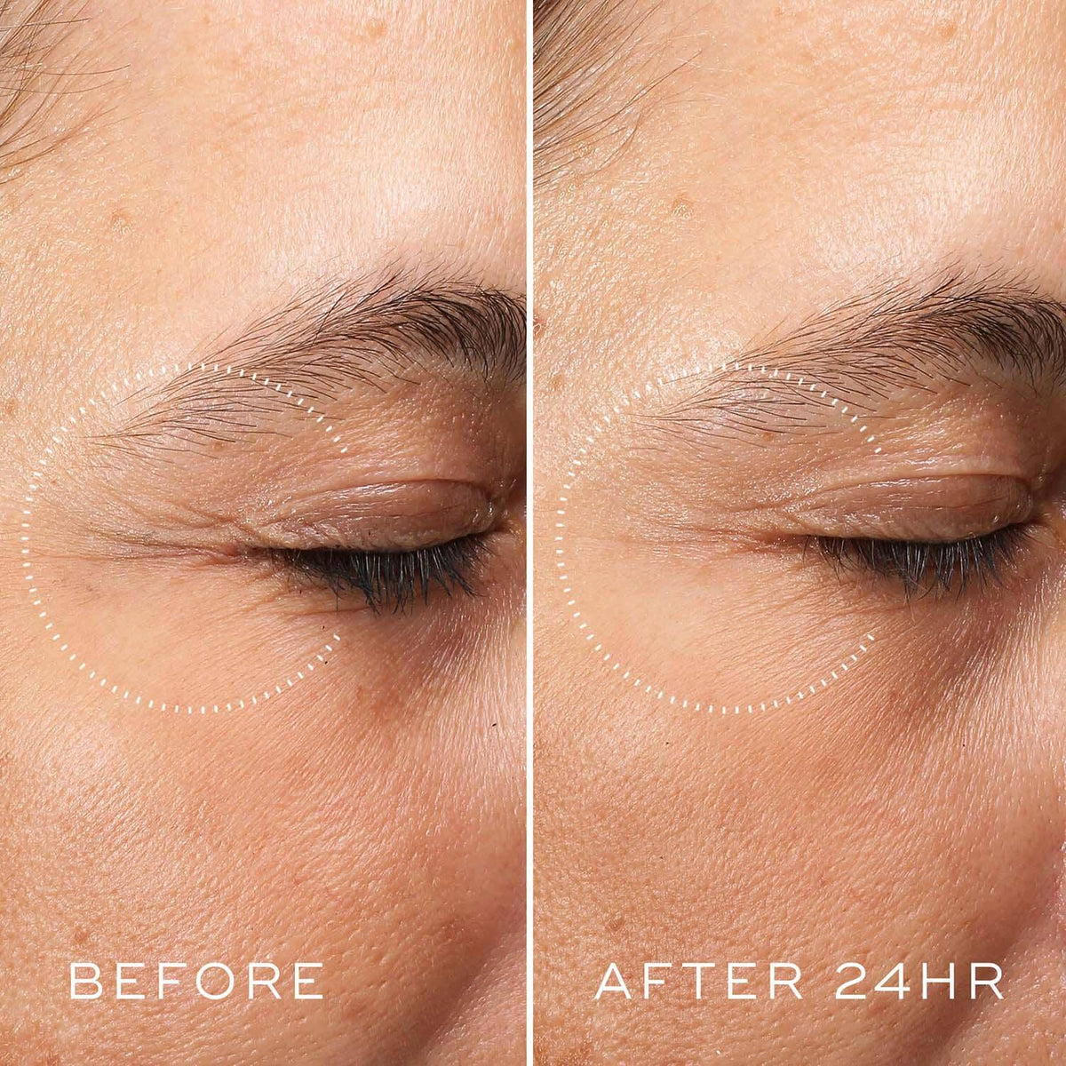 Medik8 Crystal Retinal Ceramide Eye 3 15ml