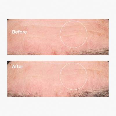 THE ORDINARY Hyaluronic Acid 2% + B5 30ml