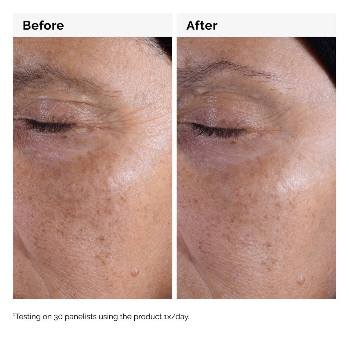 The Ordinary Glycolic Acid 7% Exfoliating Toner 100ml