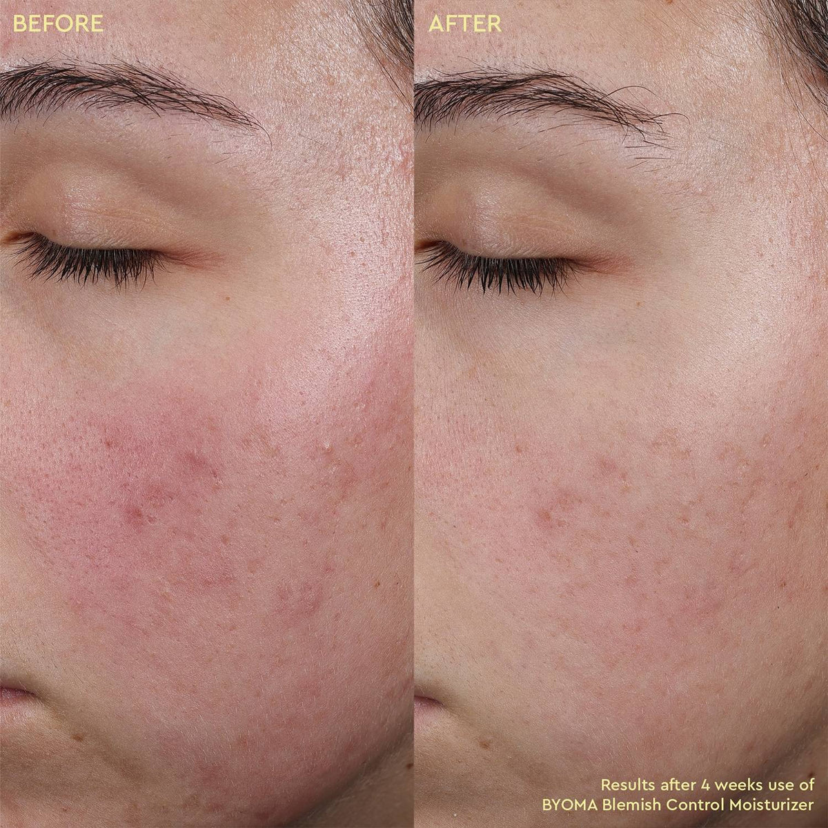 BYOMA Blemish Control Moisturizer 50ml
