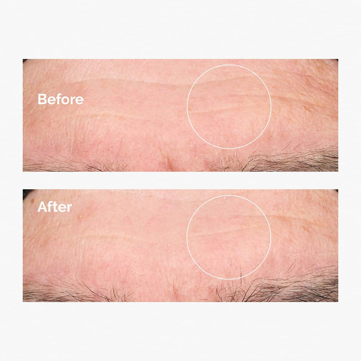 THE ORDINARY Hyaluronic Acid 2% + B5 60ml